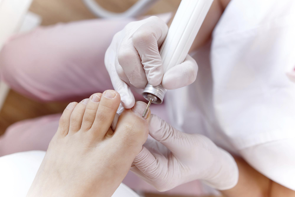 Mobile medizinische Fußpflege Donaueschingen Nagelbehandlung